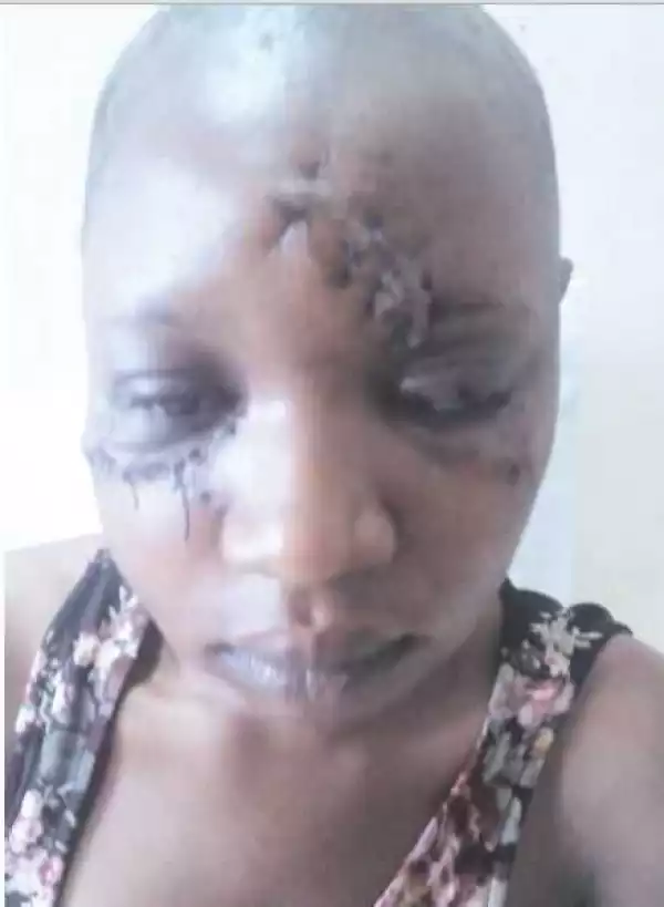 Shocking – How Man Attacked Two Sisters With Machete Over Pregnancy